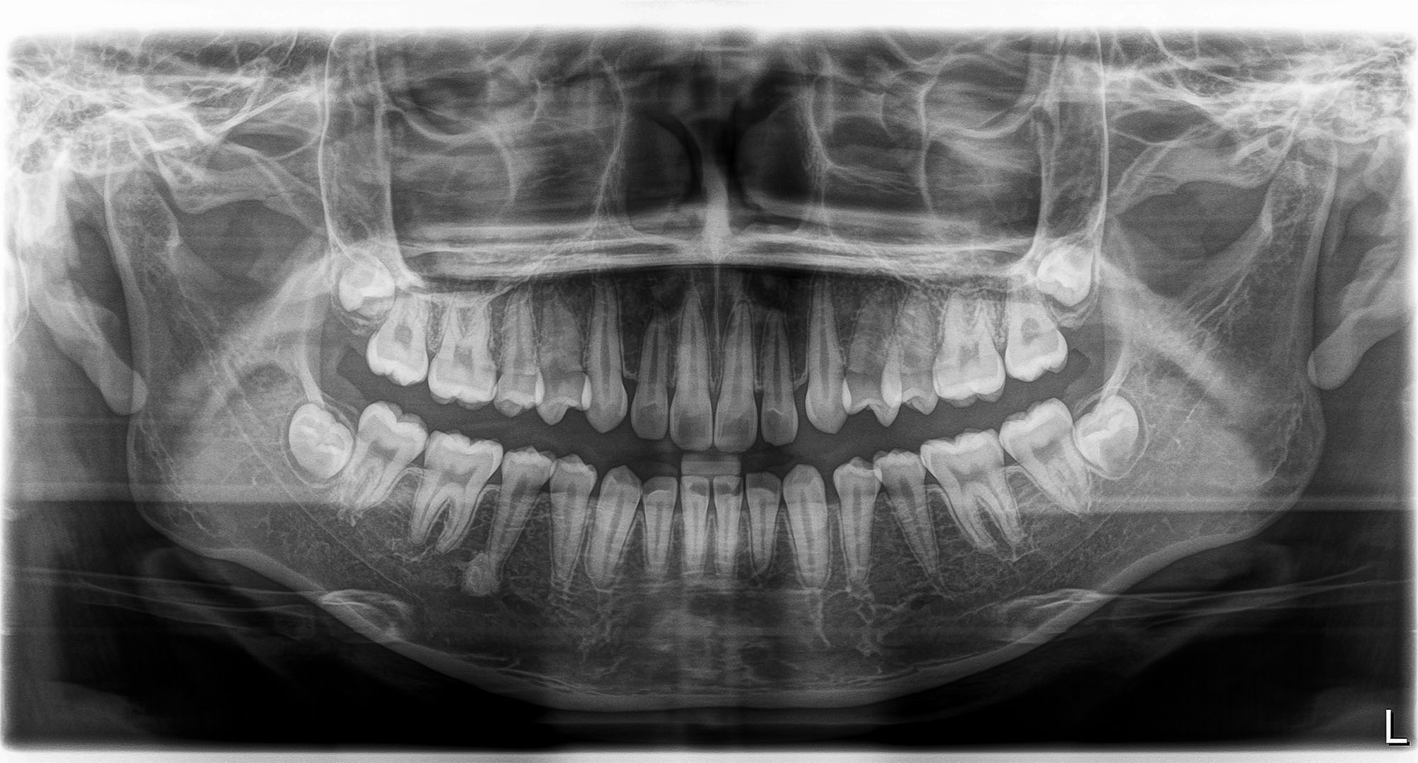 Cirugía y Traumatología Bucomaxilofacial